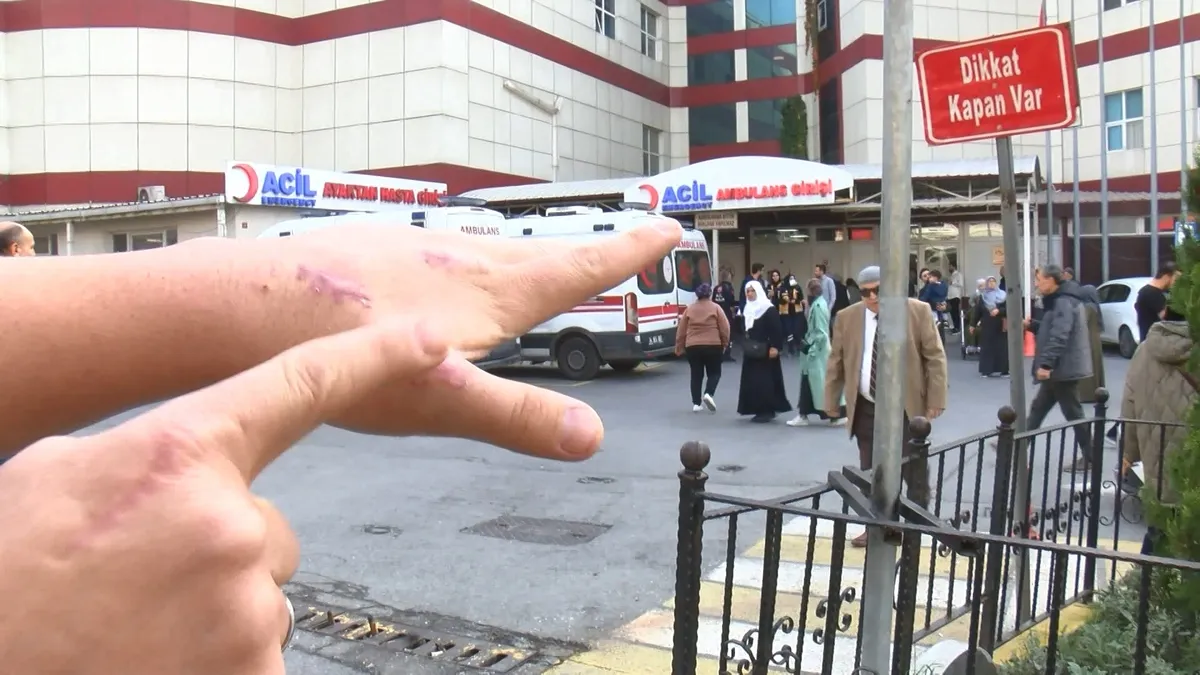 Esenyurt’ta başına öyle bir olay geldi ki: Dünyada bir ilk! Meğer kedisi ısırınca… Esenyurt’ta başına öyle bir olay geldi ki: Dünyada bir ilk! Meğer kedisi ısırınca…