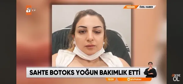 mersinde-sahte-botoks-kabusu-guzellik-ugruna-yogun-bakimlik-oldular-gunlerce-bilinc-kaybi-yasadim-1790839307048.jpeg