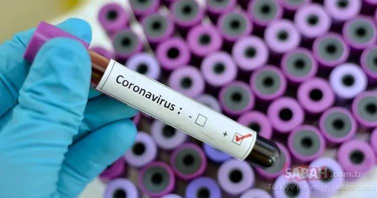 Son Dakika Haberi: Corona virüsü 2004 yılında üretildi! Pasteur Enstitüsü ile ilgili sosyal medyayı sallayan iddia!