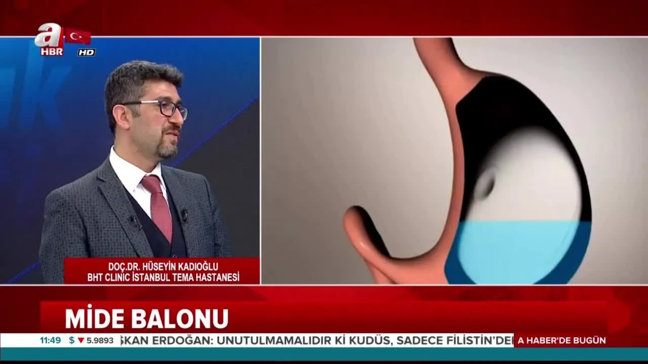 Mide Botoksu Nedir Obeziteden Kurtulma Yollari Neler Mide Botoksu Zayiflatir Mi Videosunu Izle Son Dakika Haberleri