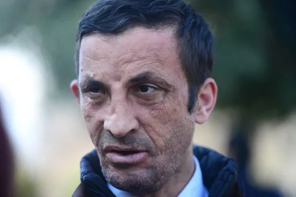 Yeni yüzü, yeni yaşamı ve son haliyle Uğur Acar
