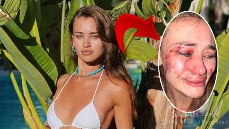 Son dakika haberi: Ünlü Top Model Daria Kyryliuk’un dövüldüğü iddia edilen ’The Beach of Momo’ isimli mekana flaş ceza!