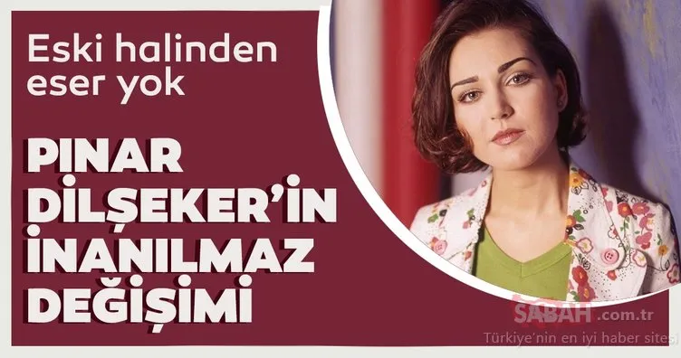 Pınar Dilşeker estetiğin dozunu kaçırdı! Onu tanıyabilmek artık çok zor