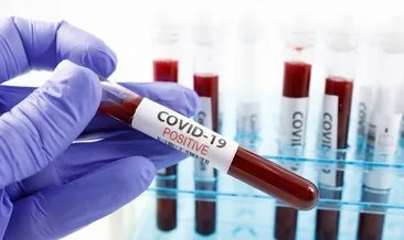 Oxford Üniversitesi’den iyi haber! Koronavirüse yakalananlar 6 ay bağışıklık kazanıyor