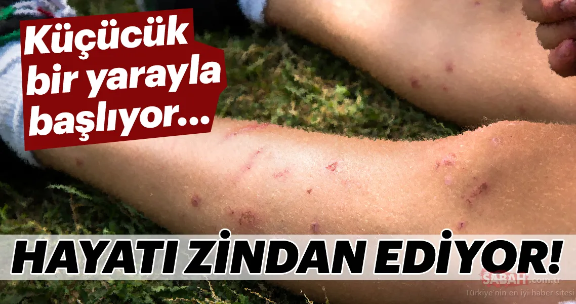 hayati zindan ediyor