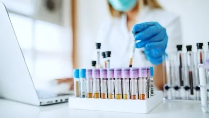 Kanda Glukoz Nedir? Kan Tahlilinde Glukoz Serum Plazma Yüksekliği ve Düşüklüğü Neden Olur, Kaç Olmalı?