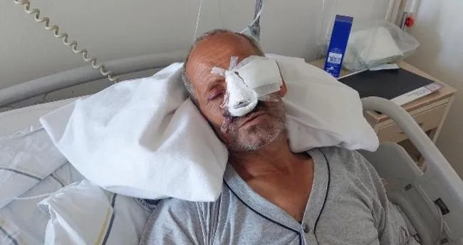 Elektrikli testere yüzünü kesti: Gözünü kaybetme riski var… Elektrikli testere yüzünü kesti: Gözünü kaybetme riski var…