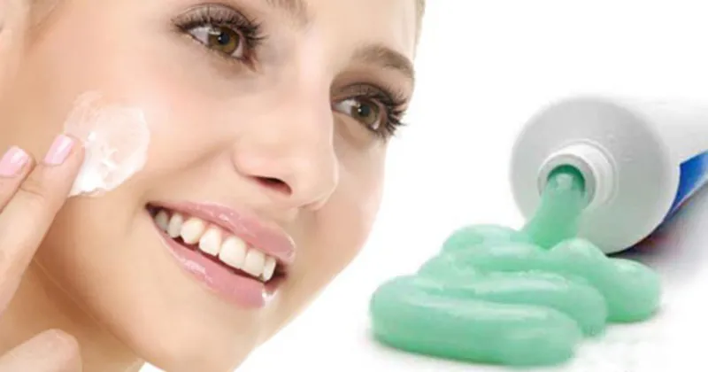 sivilceye dis macunu surmek zararli mi dis macunu sivilce gecirir mi etkisi nedir saglik haberleri