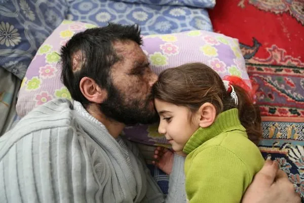 Cumhurbaşkanı Erdoğan, Suriyeli Gözyaşı ve ailesini kabul etti