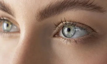 Gözdeki bu belirtiye dikkat! Körlüğün sinyali olabilir...