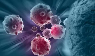 Kanser Belirtileri - Kanserin İlk Belirtileri Nelerdir, Başlangıcı Nasıl Anlaşılır?