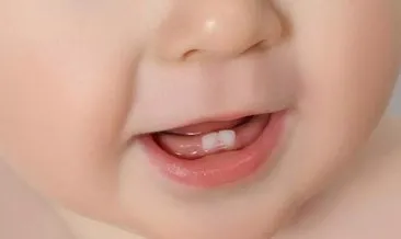 Rüyada Kendi Bebeğinin Dişinin Çıktığını Görmek Ne Anlama Gelir? Rüyada Bebeğinin Dişinin Çıkmasının Anlamı