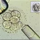 Yüksek Sağlık Şurası, tüp bebek uygulamasının Türkiye’de de başlatılmasını kararlaştırdı