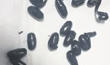 Midesinden uyuşturucuyu çıktı