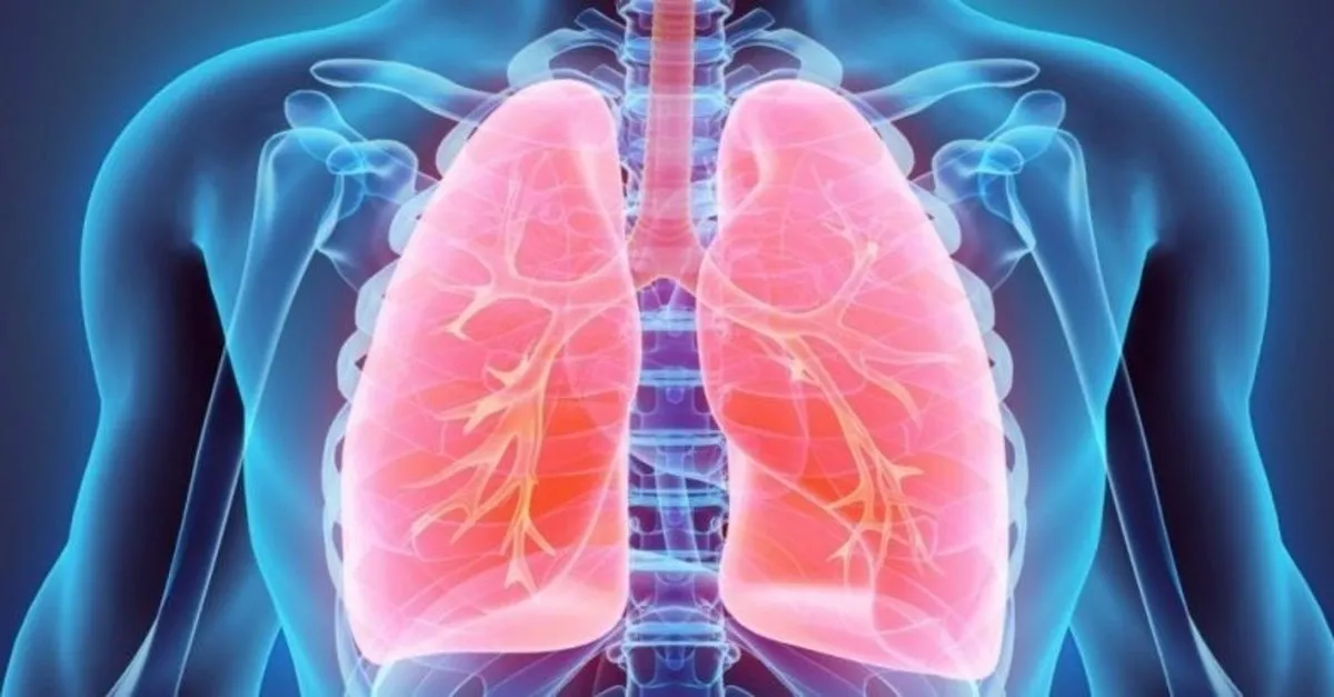 akciger enfeksiyonu nedenleri