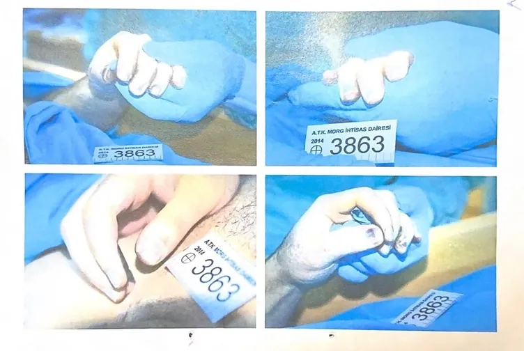 Türkiye'nin konuştuğu Cem Garipoğlu davasında flaş gelişme! SABAH otopsi fotoğraflarına ulaştı