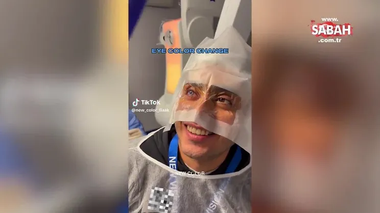 Dehşete düşüren estetik akımı! Mavi göz uğruna kör kalmayı tercih ediyorlar | Video