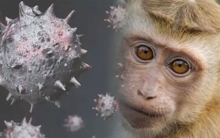 Dünya Sağlık Örgütü’nden kritik Maymun çiçeği virüsü uyarısı: Maymun çiçeği virüsü nedir, belirtileri neler, nasıl bulaşır?