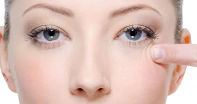 goz alti sisligine ne iyi gelir iste goz alti torbalarina ve sisligine iyi gelecek dogal ve bitkisel tedavi onerileri saglik haberleri