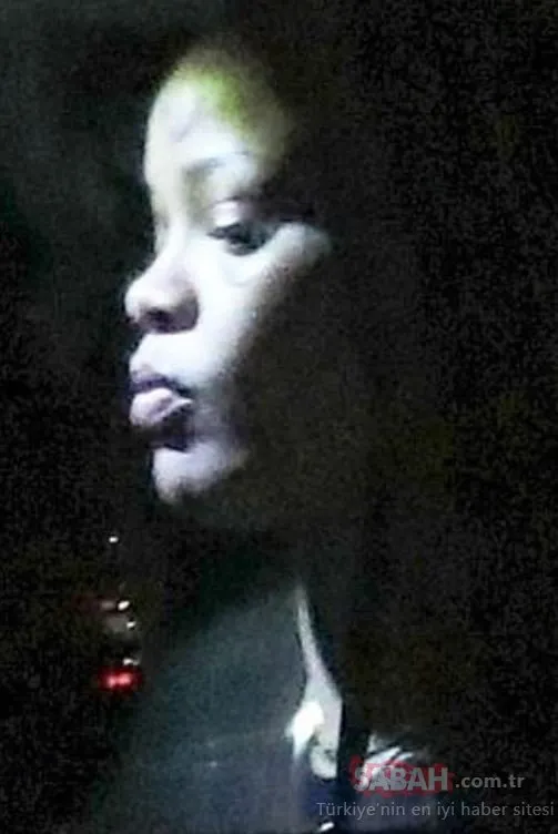 Rihanna�nın yüzü neden mosmor? Rihanna son hali ile hayranlarını