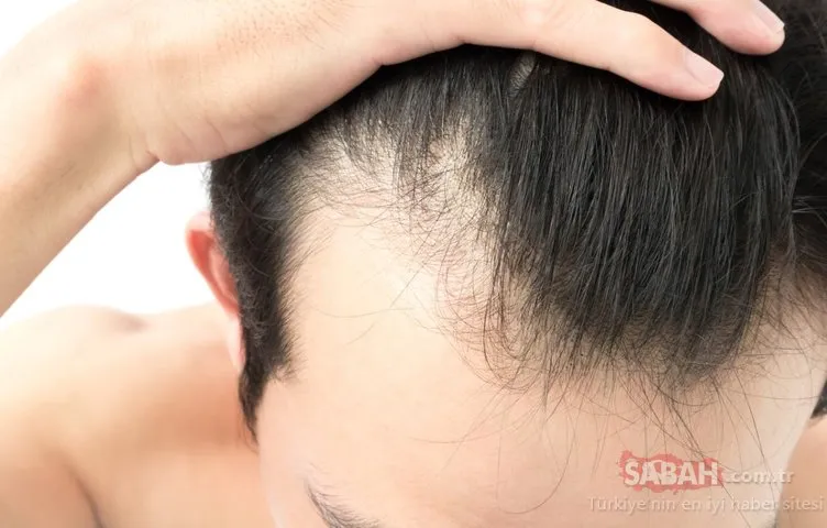 Erkekler için doğal saç çıkarma yöntemi...