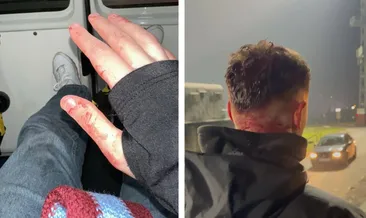 Bosna Hersek’te Trabzonspor taraftarına çirkin saldırı!