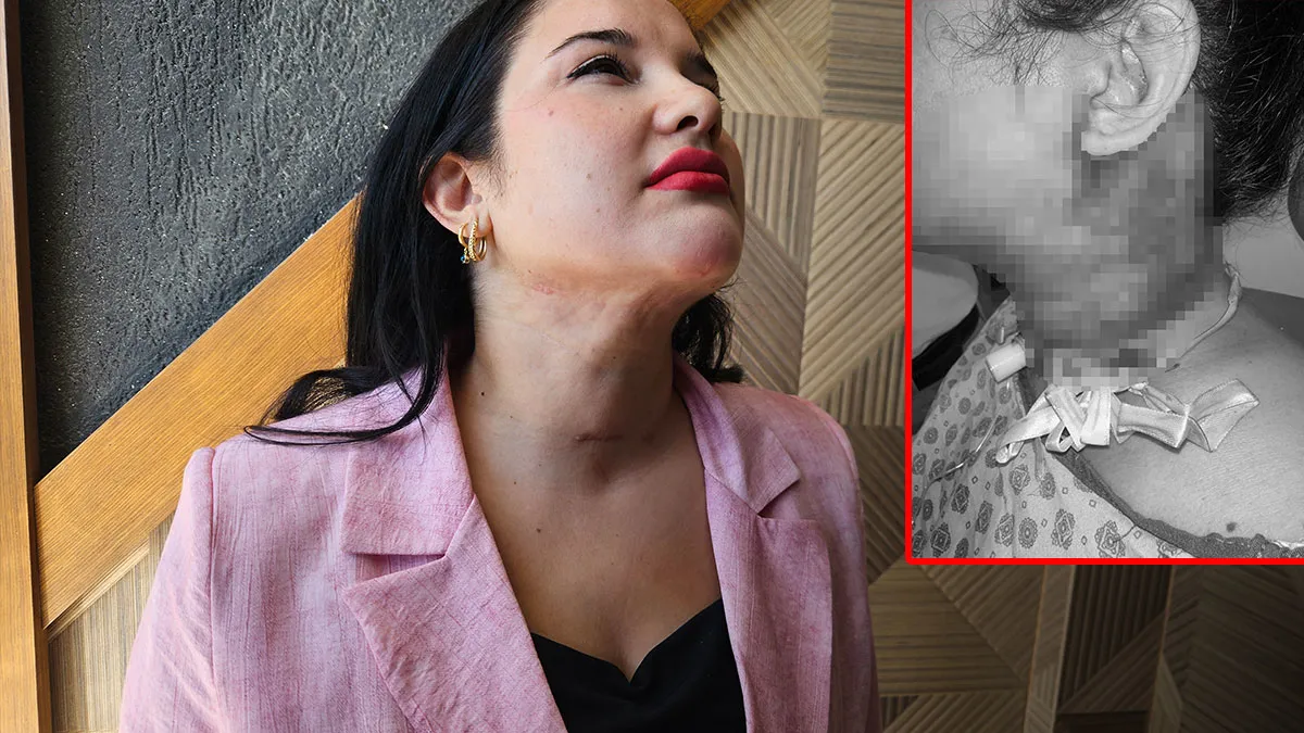 Antalya'da estetik isteği yoğun bakıma düşürdü: Doktordan böyle şikayetçi oldu! 'Hocam nefes alamıyorum'