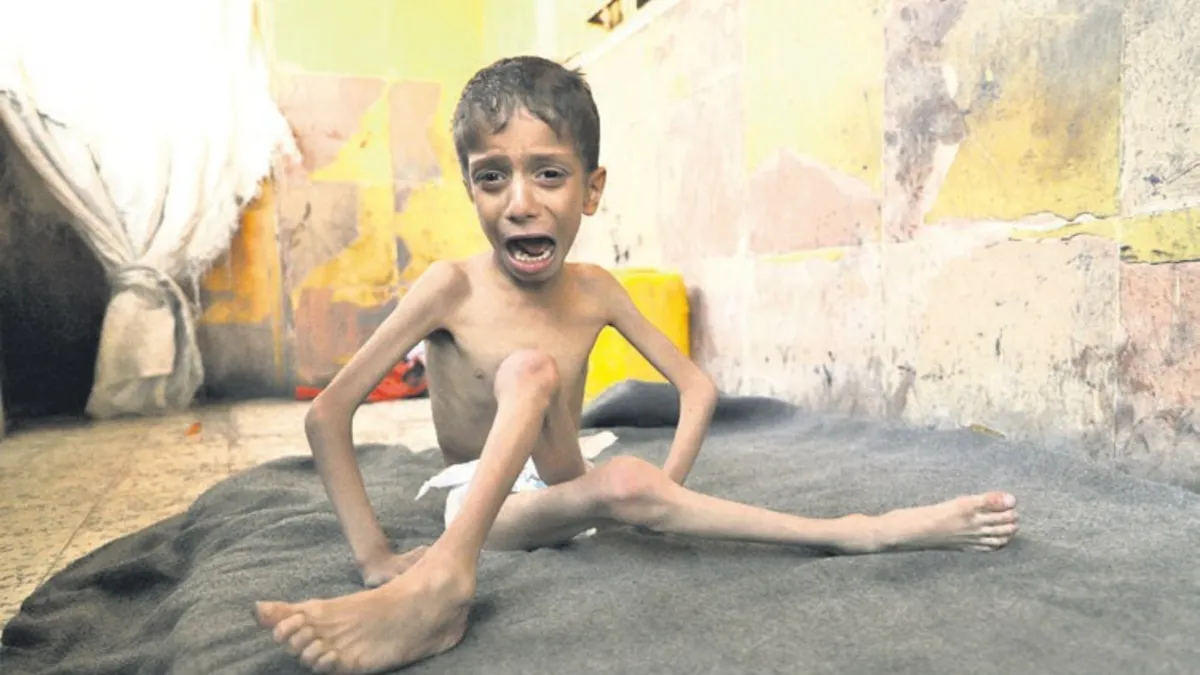 İnsanlığın vicdanı Gazze’de donuyor – Son Dakika Haberler İnsanlığın vicdanı Gazze’de donuyor – Son Dakika Haberler