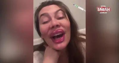 Demet Evgar botoks ve dolguyu fazla kaçıranları böyle ti’ye aldı | Video