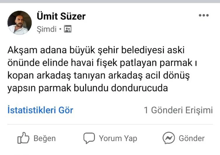 Adana Demirspor taraftarının parmağı kopmuştu! Şok gerçeği hastanede öğrendi!