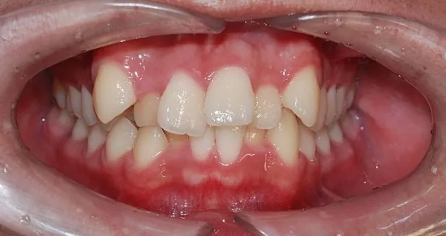 Psikolojiyi olumsuz etkiliyor Sağlık Haberleri