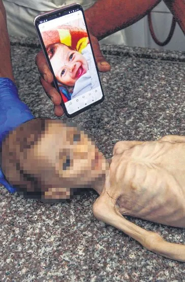 7 aylık bebeği açlıkla: Katlettiler