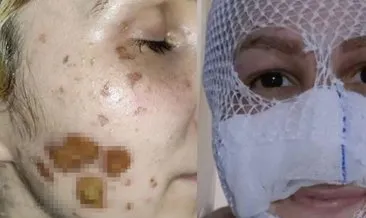 Kız arkadaşının yüzüne kimyasal madde atmıştı! Duruşmada tepki çeken sözler: Eline mermi verdiğim doğrudur ama... #ankara Kız arkadaşının yüzüne kimyasal madde atmıştı! Duruşmada tepki çeken sözler: Eline mermi verdiğim doğrudur ama... #ankara