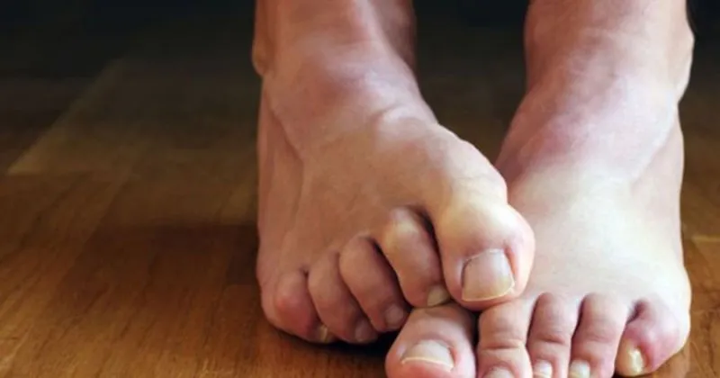 huzursuz bacak sendromu belirtileri