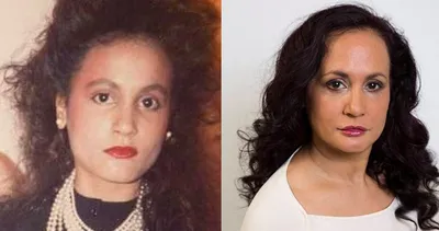 40 yıldır gülmüyor! Ardındaki neden herkesi şoke etti: Bu yöntem daha etkili...