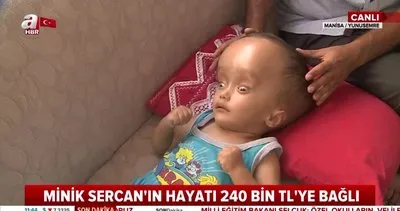 Manisa’da yürek burkan görüntü! 2 yaşındaki Sercan hidransefali hastası... Yaşamak için 240 bin TL’ye ihtiyacı var | Video