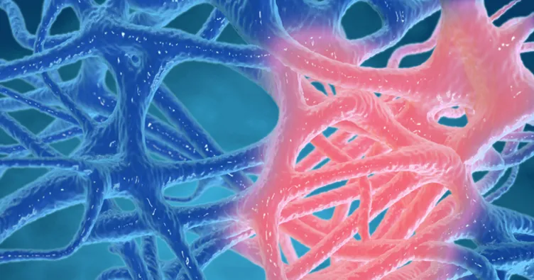 İltihaba Ne İyi Gelir? Vücuttaki İltihap Doğal Yollardan Nasıl Atılır ...