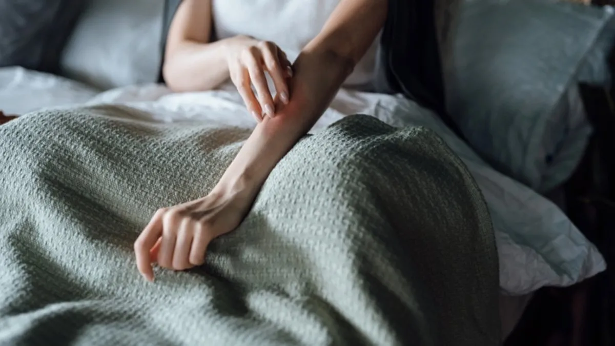 Sedef hastalığı tarih oluyor! Uzmanlardan “sedefsiz hayat mümkün” müjdesi! Sedef hastalığı tarih oluyor! Uzmanlardan “sedefsiz hayat mümkün” müjdesi!