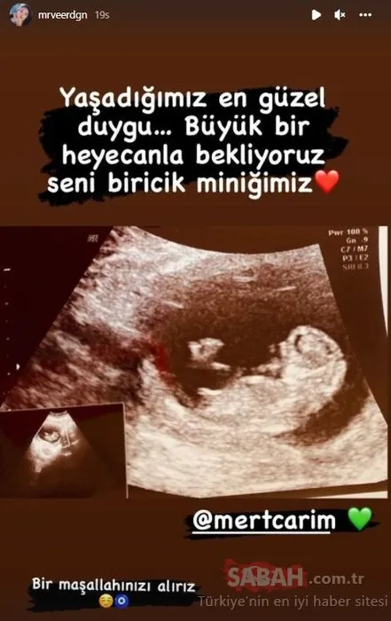 Bücür Cadı Zeliş büyüdü de anne oluyor! Bir zamanların çocuk yıldızı Merve Erdoğan bebeğinin cinsiyetini açıkladı!