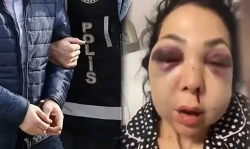 İzmit’te anne ve oğluna saldırıda 1 kişi tutuklandı #kocaeli