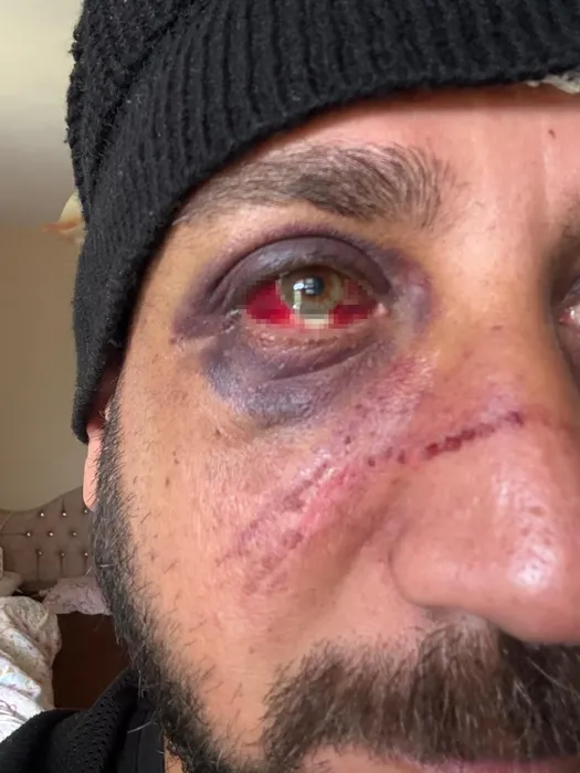 Adana’da eski sevgili dehşeti! 470 bin TL borcunu alamadı üstüne dayak yedi!