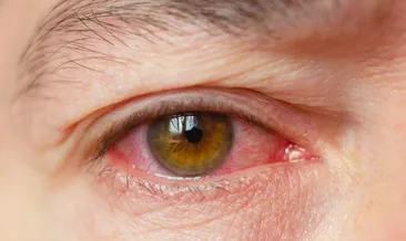 İlk sinyalini gözlerde veriyor! Yüksek tansiyonu olanlar için tehlike çanları