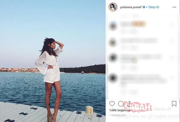 Cildi yüzünden herkes alay ediyordu... Şimdi dünya markaları peşinden koşuyor!
