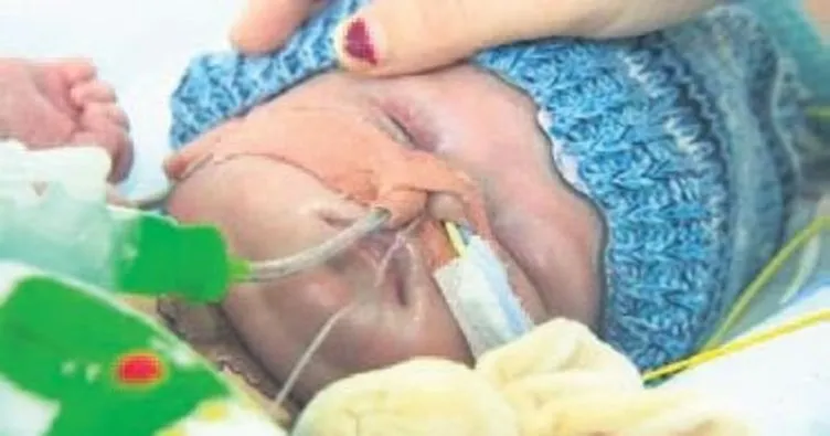 8 haftalık bebeğe kalp nakli yapıldı