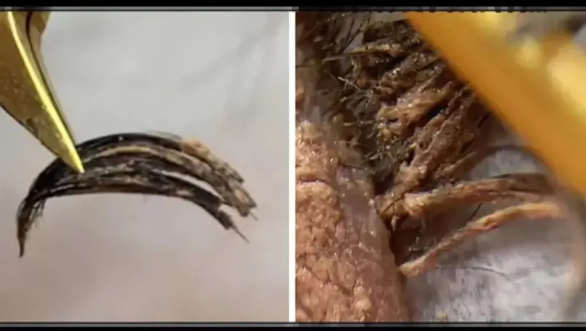 Buna bakmak bile gözlerinizi sulandıracak! Şimdiye kadar görebileceğiniz en korkunç kirpik işlemi: Uzmanlar bile şokta