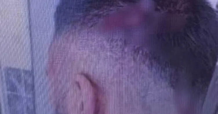 Şanlıurfa’da öğretmene sopalı saldırı