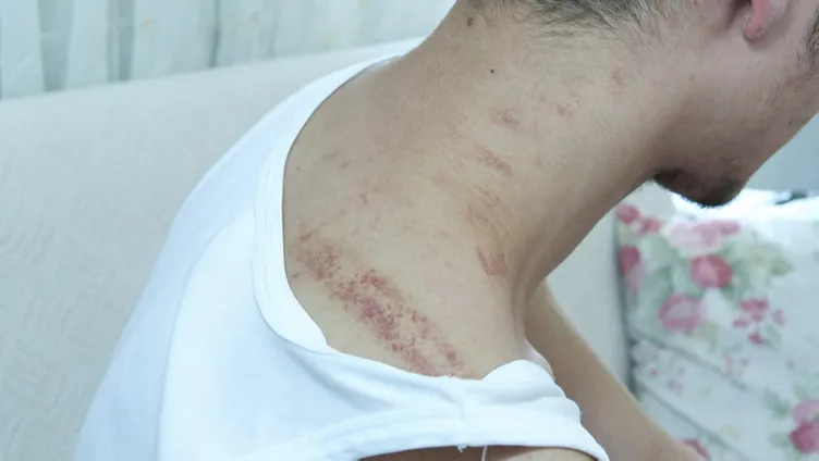 Akaryakıt istasyonunda bayıltan dayak! Dakikalarca dövülen gencin babası isyan etti: Vicdanınız yok mu...