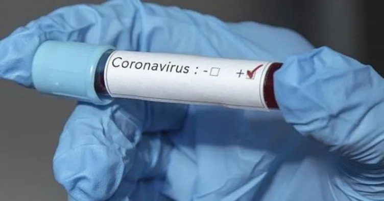 Honduras’da ilk kez yeni tip koronavirüs vakaları görüldü