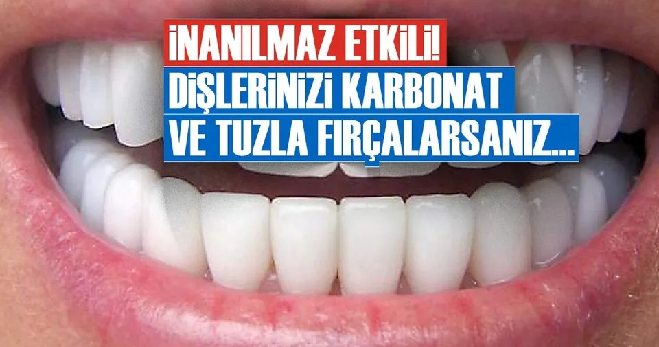 evde dis plagi temizleme yollari saglik haberleri