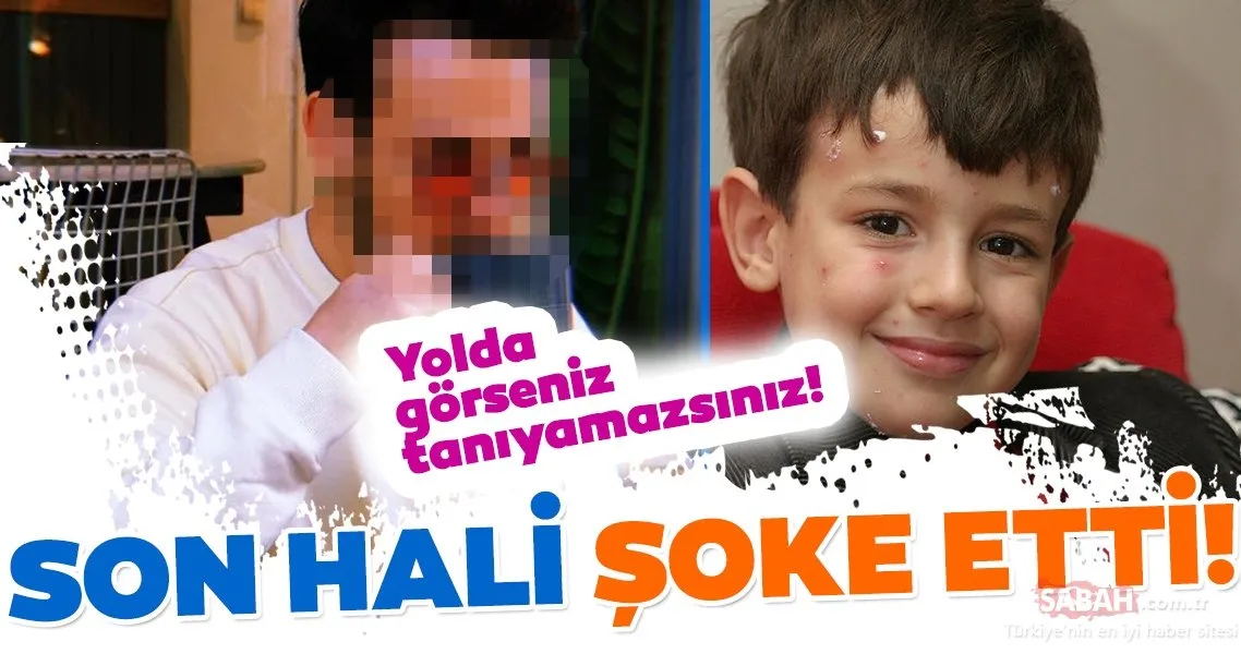 Babam ve Oğlum filminin küçük yıldızı Ege Tanman son haliyle şoke etti